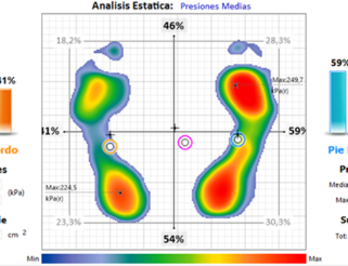 Escáner 3D – Plantillas a medida